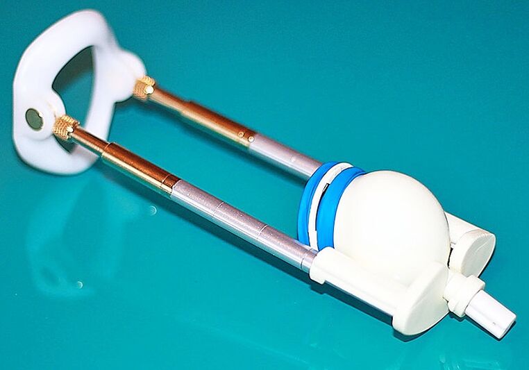 ilgintuvas varpos pailginimui